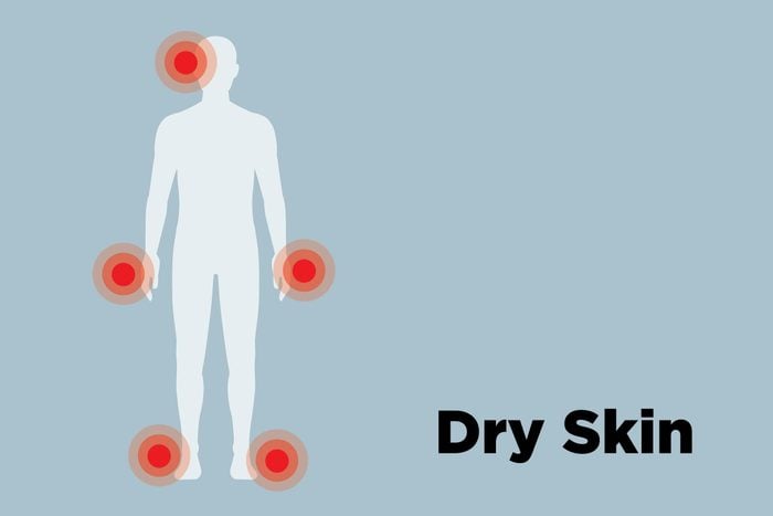 illustration of male body with dry skin hot spots
