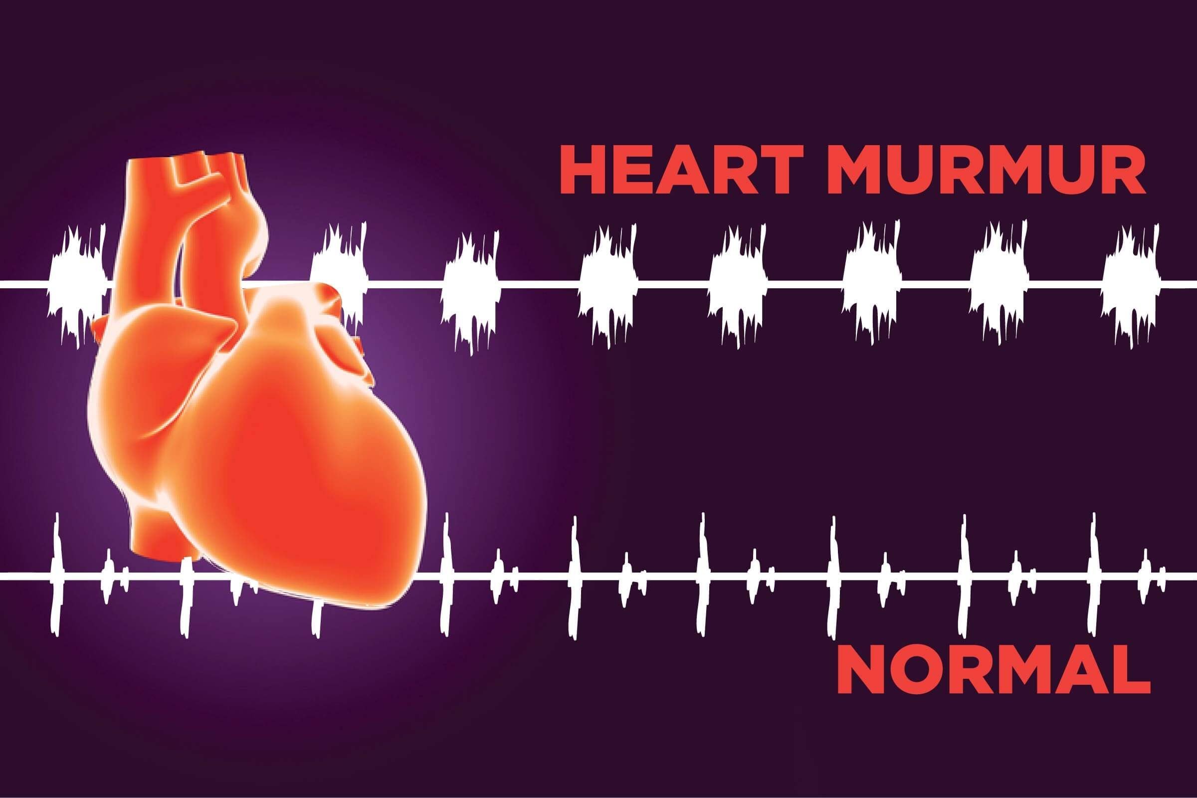Heart Murmur Silent Signs You Need To Know The Healthy