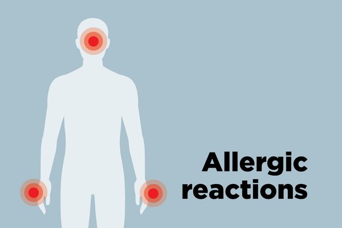 outline of body showing allergic reaction hotspots