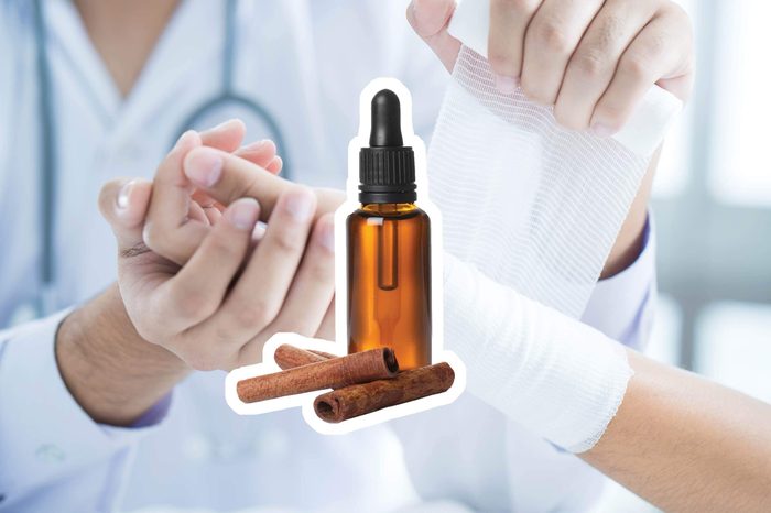 Cinnamon oil over a doctor wrapping a patient's wrist