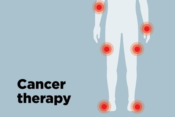 outline of body showing cancer therapy hotspots