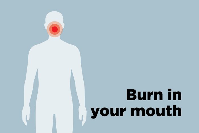 outline of body showing burned mouth hotspot