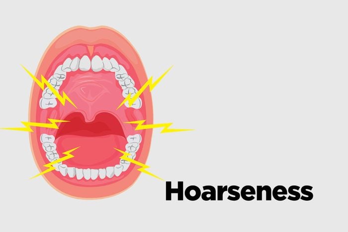 Illustration of an open mouth with a hoarse voice.