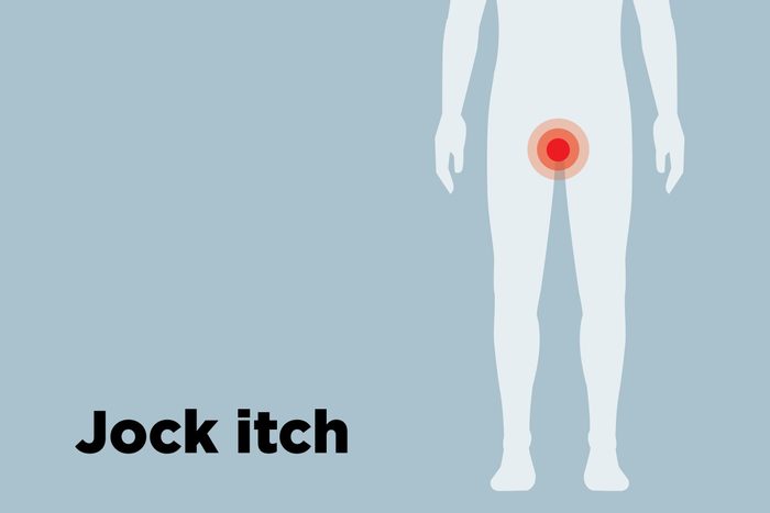 outline of body showing jock itch hotspots