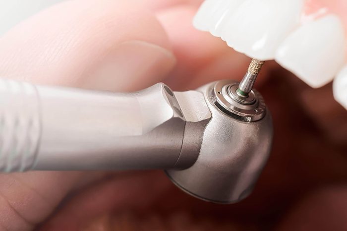 very close shot of dental drill on tooth