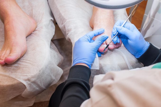 Gloved hands of a doctor treating toenail fungus