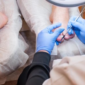 toenail fungus podiatrist rubber gloves foot feet caucasian doctor