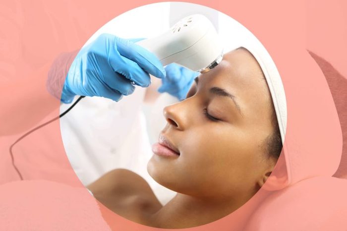 Black woman receiving acne treatment with a machine
