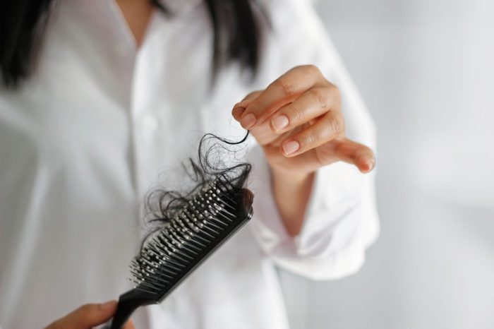 hair loss in women insulin resistance