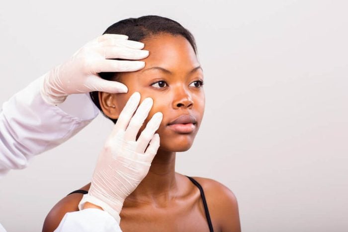 dermatologist checking the skin on a young woman's face 