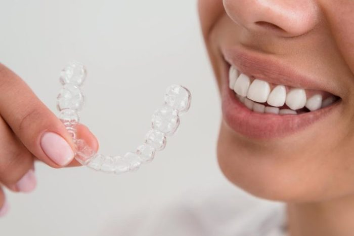 Woman with a beautiful smile holding a transparent mouth guard.