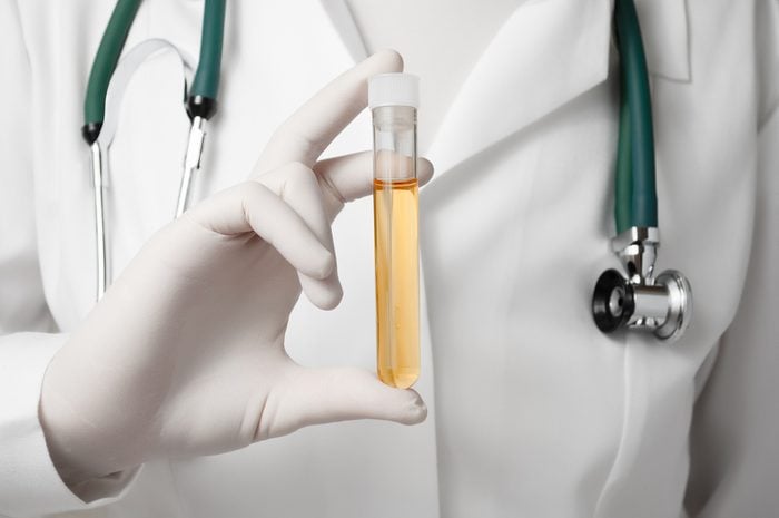 Doctor holding a bottle of urine sample