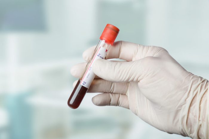 Person holding a vial of blood with a gloved hand.