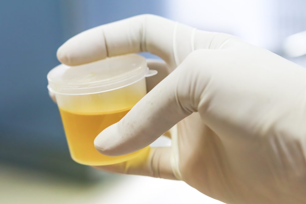 urine specimen cup