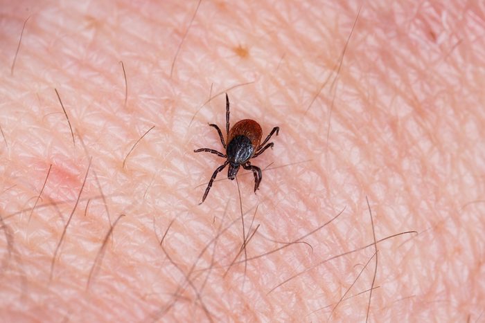 Closeup of a tick on a skin