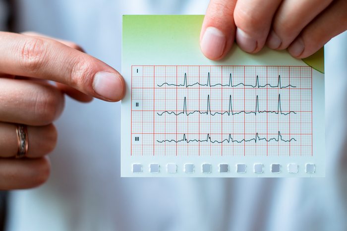 Electrocardiogram, ecg in hand, palm of a doctor. 