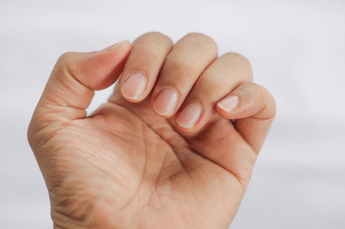 Closeup of a man's finger nails.