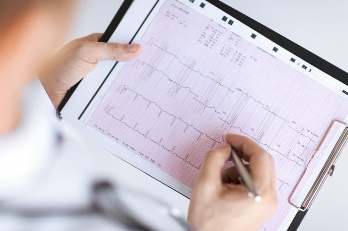 male doctor hands with cardiogram