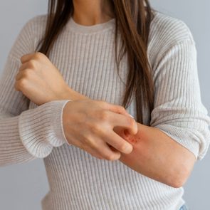 cropped shot of woman scratching arm