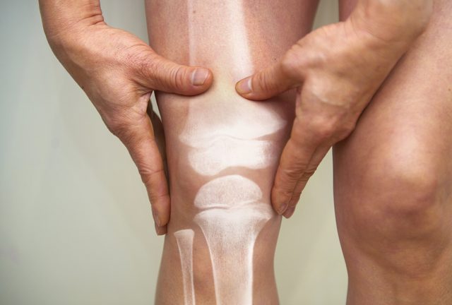 cartilage in knee and joints concept