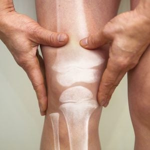 cartilage in knee and joints concept
