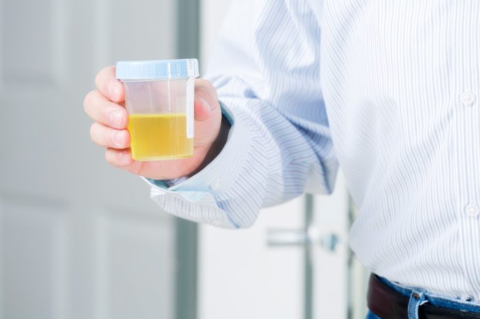 man holding urine sample cup