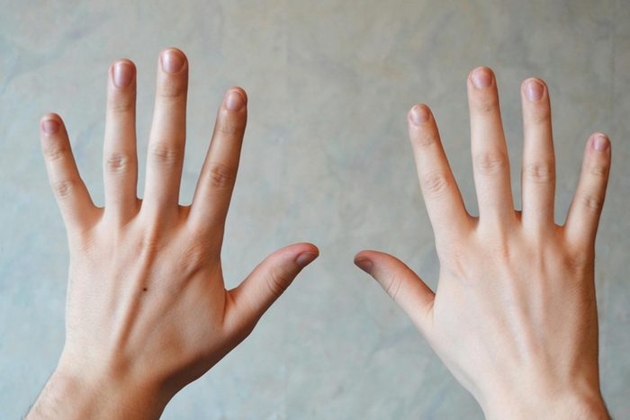 hands with fingers spread out