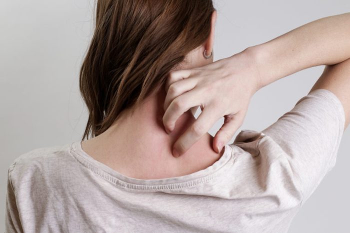 Close up view of woman scratching her neck. 