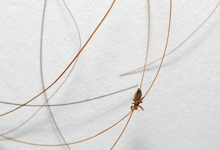 Head lice are tiny insects that live on the skin covering the top human head.