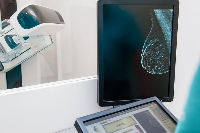 breast mammogram image on monitor