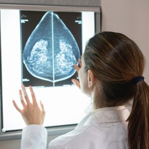 doctor examining mammogram results