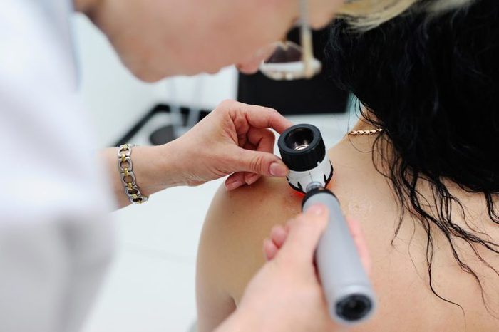 13 Silent Signs of Skin Cancer You're Probably Ignoring