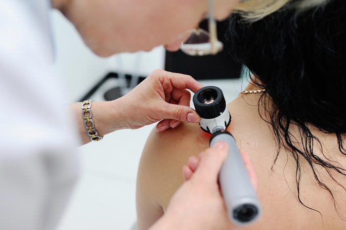 13 Silent Signs of Skin Cancer You're Probably Ignoring