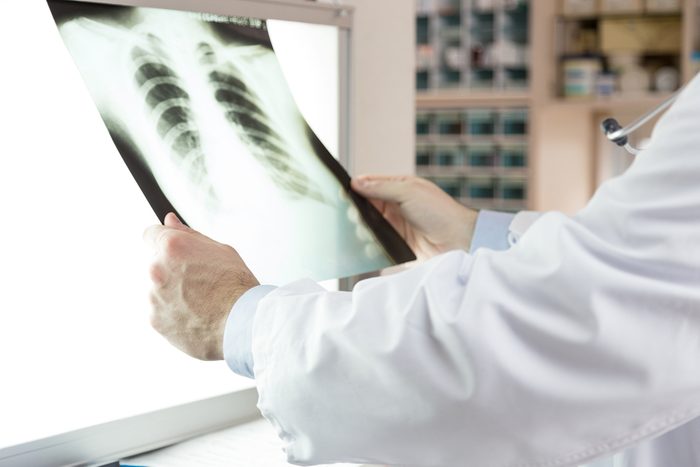 A doctor checking x-ray photo of patients. Xray of lungs. hospital. medical check. 