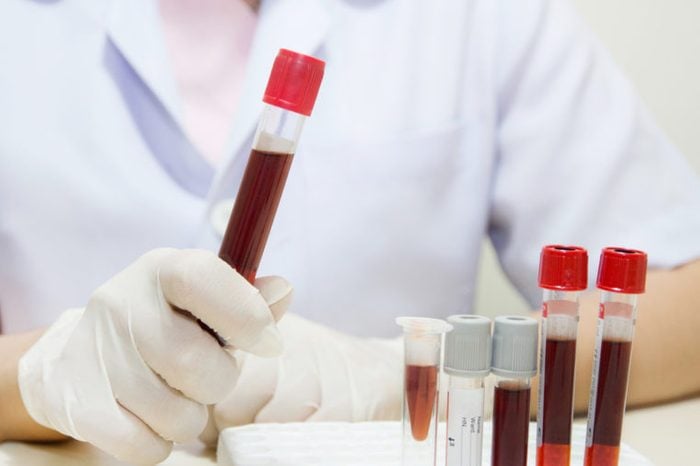close-up van een jonge vrouwelijke holdingsbuis met het maken van bloedmonsters en testen of onderzoek in klinisch laboratorium