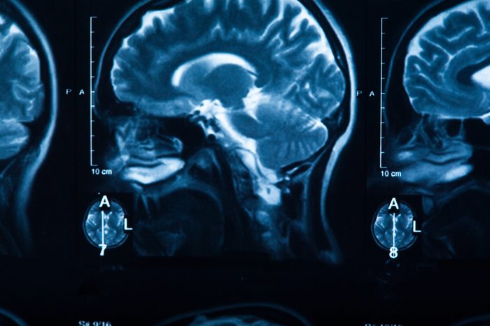 The X-ray of the human brain closeup image