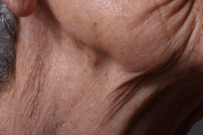 Wrinkles on the chin and neck of an elderly woman.