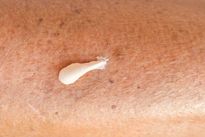 lotion blob on tanned skin