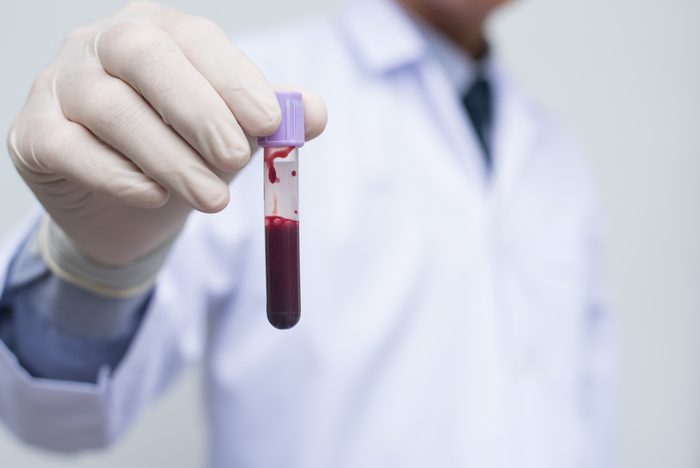 Male doctor or technician holding red blood ( fresh whole blood) in test tube and blood group icon. It is real human fresh blood. Blood donation concept.