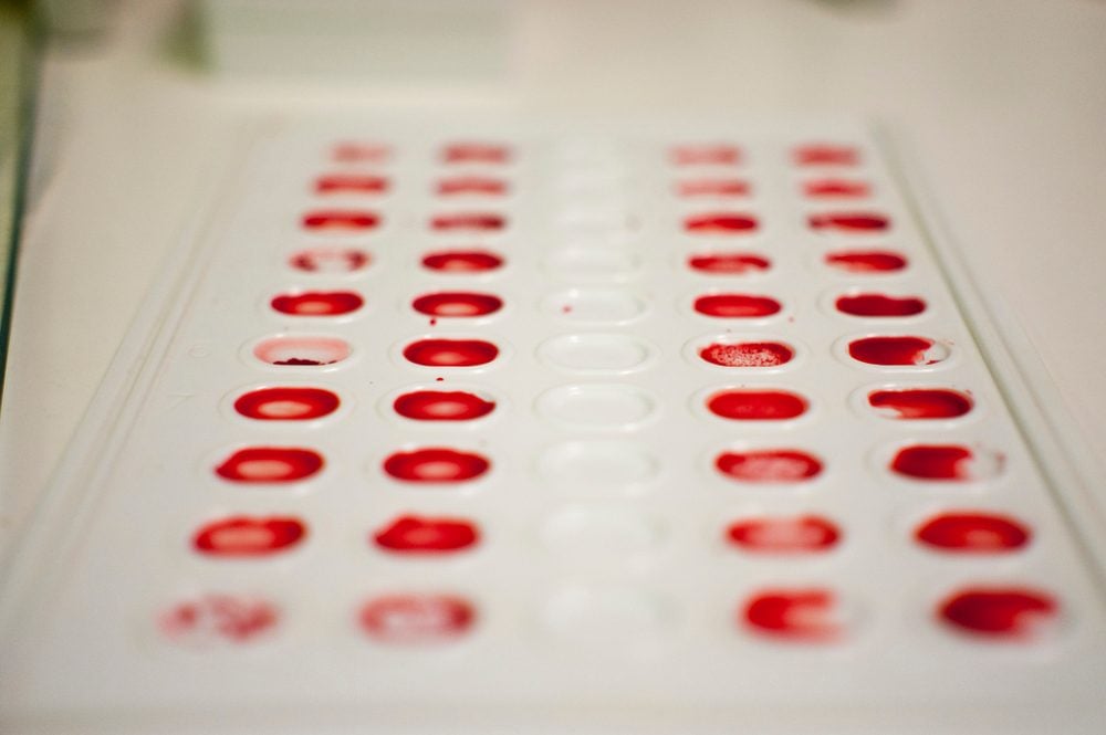 This Is the Rarest Blood Type in the World