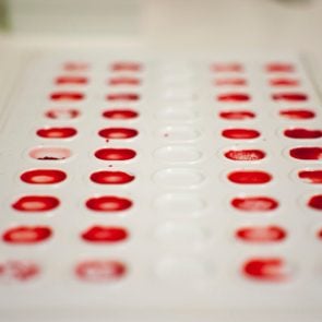 blood type - determination; Blood group and rh factor testing by agglutination method
