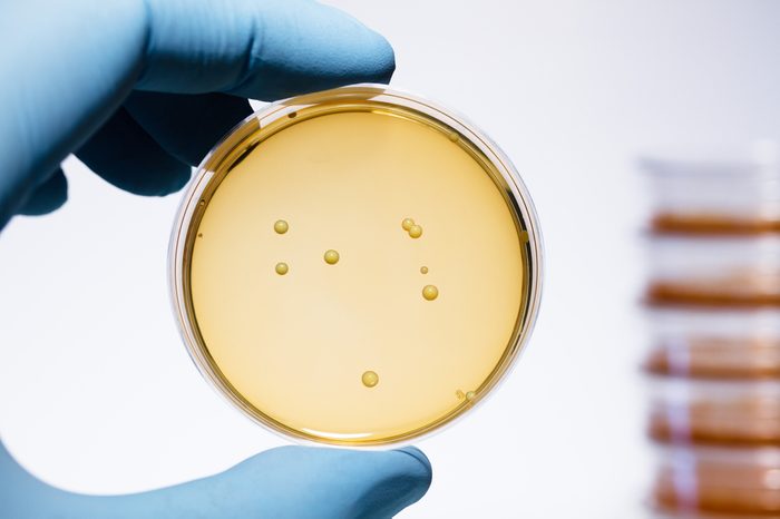 Lactobacillus bacteria colonies. A gloved hand holding a Petri dish that contains Gram-positive lactobacillus bacteria grown on agar. Lactobacillus is a common yogurt probiotic.
