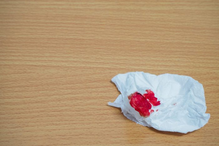 blood on a tissue or napkin