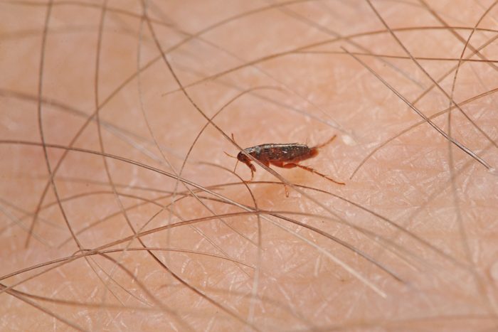 Flea walking on a human skin. A tiny parasite sucking humans blood on a close up horizontal picture.