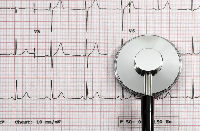 Top view of stethoscope on EKG graph or electrocardiogram to test measures the electrical signals that control heart rhythm.
