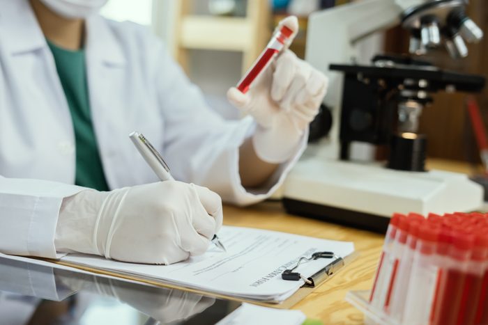 medical doctor 's hand holding blood sample and making notes writing patients data on prescription,lab technician use microscope and test tube in laboratory background