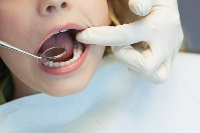 close up of dentist examining patient's mouth