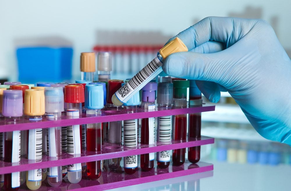 hand of a lab technician taking a tube of blood from a rack and the background color tubes with samples from other patients/ hand of laboratory technician holding a blood tube for analysis