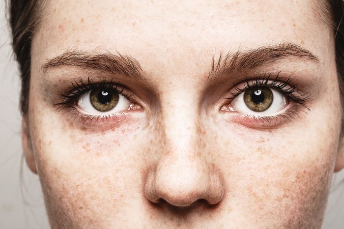 closeup of freckled womans eyes and face