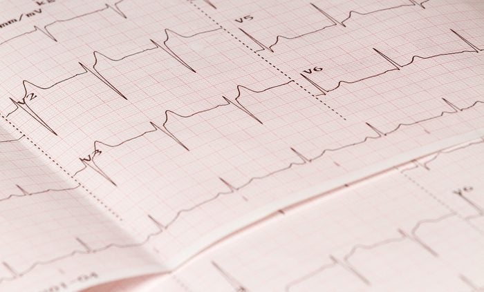 Electrocardiogram close-up